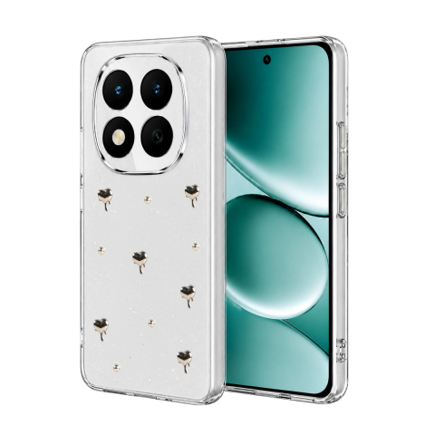 Xiaomi Redmi Note 15 Pro 5g Fiyonk Desenli Kapak - Desen 1